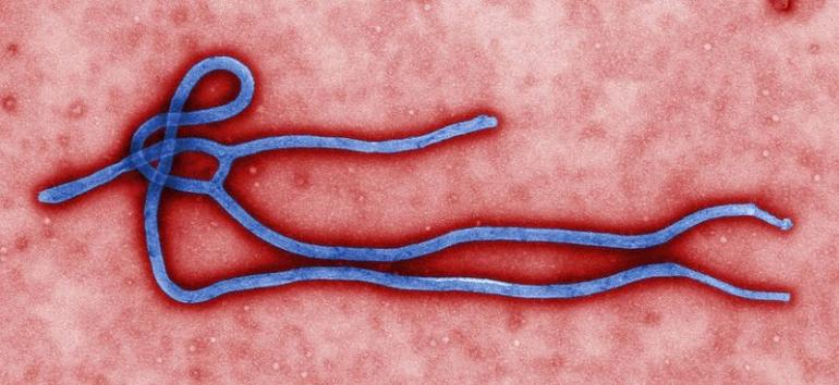 The Ebola Virus: What You Need to Know